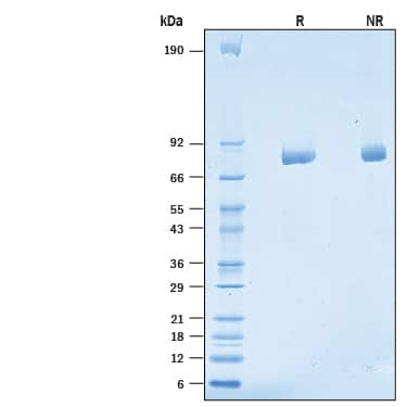 2 μg/lane of Recombinant Human LRRN2 His-tag was  resolved with SDS-PAGE under reducing (R) and non-reducing (NR)  conditions and visualized by Coomassie® Blue staining, showing bands at 73-81 kDa.