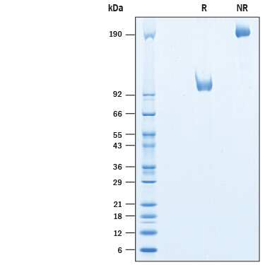 SDS-PAGE LRRTM1 [Unconjugated]