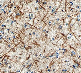 LRRTM3 was detected in immersion fixed paraffin-embedded sections of human brain with Alzheimer's disease using Human LRRTM3 Monoclonal Antibody (Catalog # MAB4898) at 15 µg/mL overnight at 4 °C. Before incubation with the primary antibody, tissue was subjected to heat-induced epitope retrieval using Antigen Retrieval Reagent-Basic (Catalog # CTS013). Tissue was stained using the Anti-Mouse HRP-DAB Cell & Tissue Staining Kit (brown; Catalog # CTS002) and counterstained with hematoxylin (blue). View our protocol for Chromogenic IHC Staining of Paraffin-embedded Tissue Sections.