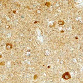 LTK was detected in immersion fixed paraffin-embedded sections of human brain (cortex) using Sheep Anti-Human LTK Antigen Affinity-purified Polyclonal Antibody (Catalog # AF4664) at 10 µg/mL overnight at 4 °C. Before incubation with the primary antibody, tissue was subjected to heat-induced epitope retrieval using Antigen Retrieval Reagent-Basic (Catalog # CTS013). Tissue was stained using the Anti-Sheep HRP-DAB Cell & Tissue Staining Kit (brown; Catalog # CTS019) and counterstained with hemotoxylin (blue). Specific staining was localized to neurons. View our protocol for Chromogenic IHC Staining of Paraffin-embedded Tissue Sections.