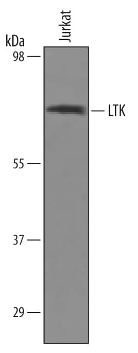 Western blot shows lysates of Jurkat human acute T cell leukemia cell line. PVDF Membrane was probed with 1 µg/mL of Sheep Anti-Human LTK Antigen Affinity-purified Polyclonal Antibody (Catalog # AF4664) followed by HRP-conjugated Anti-Sheep IgG Secondary Antibody (Catalog # HAF016). A specific band was detected for LTK at approximately 70 kDa (as indicated). This experiment was conducted under reducing conditions and using Immunoblot Buffer Group 8.