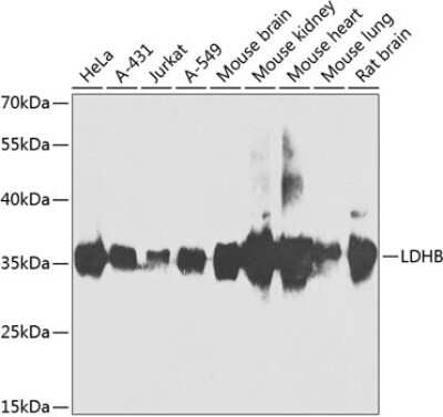 Lactate Dehydrogenase B Antibodies: Novus Biologicals