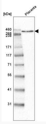 Western Blot: Laminin alpha 5 Antibody (CL3118) [NBP2-42391] - Analysis in human placenta tissue.