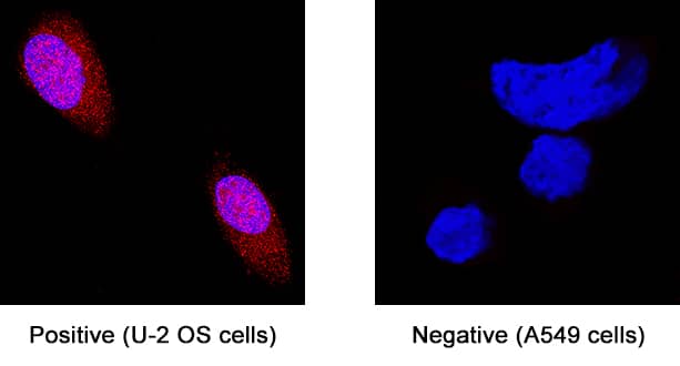 Laminin a1 was detected in immersion fixed U2OS human osteosarcoma cell line (positive stain) and A549 human lung carcinoma cell line (negative stain) using Mouse Anti-Human Laminin a1 Monoclonal Antibody (Catalog # MAB4187) at 8 µg/mL for 3 hours at room temperature. Cells were stained using the NorthernLights™ 557-conjugated Anti-Mouse IgG Secondary Antibody (red; Catalog # NL007) and counterstained with DAPI (blue). Specific staining was localized to cytoplasm. View our protocol for Fluorescent ICC Staining of Cells on Coverslips.
