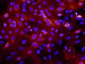 Laminin a3/Laminin-5 was detected in immersion fixed MCF 10A human breast epithelial cell line using 10 µg/mL Mouse Anti-Human Laminin a3/Laminin-5 Monoclonal Antibody (Catalog # MAB2144) for 3 hours at room temperature. Cells were stained with the NorthernLights™ 557-conjugated Anti-Mouse IgG Secondary Antibody (red; Catalog # NL007) and counterstained with DAPI (blue). View our protocol for Fluorescent ICC Staining of Cells on Coverslips.