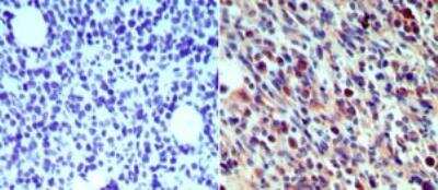 Immunohistochemistry-Paraffin: Langerin/CD207 Antibody [NB100-56733] - Analysis of langerin (CD207) in mouse breast tissue using an isotype control antibody (left) and langerin (CD207) antibody (right) at 5 ug/ml.