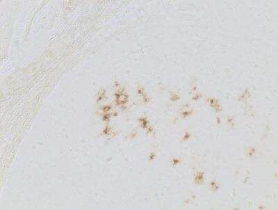 Immunohistochemistry-Paraffin: Langerin/CD207 Antibody [NB100-56733] - Human tonsil tissue. Heat mediated antigen retrieval in citrate buffer, 95C for 30 min. Image from verified customer review.