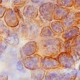     Lck  was detected in immersion fixed paraffin-embedded sections of human thymus  using Goat Anti-Human Lck Antigen Affinity-purified Polyclonal Antibody  (Catalog # AF3704) at 3 µg/mL for 1 hour at room  temperature followed by incubation with the Anti-Goat IgG VisUCyte™  HRP Polymer Antibody (Catalog # VC004).  Tissue was stained using DAB (brown) and counterstained with hematoxylin  (blue).  Specific staining was  localized to plasma membrane. View our protocol for IHC  Staining with VisUCyte HRP Polymer Detection Reagents. 