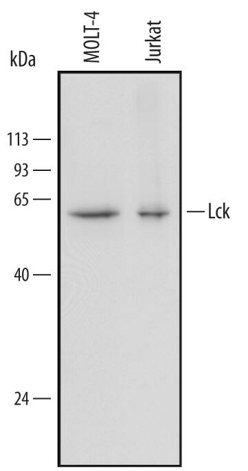 Western blot shows lysates of MOLT-4 human acute lymphoblastic leukemia cell line and Jurkat human acute T cell leukemia cell line. PVDF Membrane was probed with 0.5 µg/mL of Goat Anti-Human Lck Antigen Affinity-purified Polyclonal Antibody (Catalog # AF3704) followed by HRP-conjugated Anti-Goat IgG Secondary Antibody (HAF109). A specific band was detected for Lck at approximately 56 kDa (as indicated). This experiment was conducted under reducing conditions and using Immunoblot Buffer Group 1.