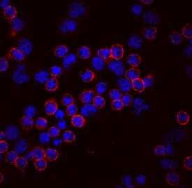 Lck was detected in immersion fixed human peripheral blood mononuclear cells (PBMCs) using Mouse Anti-Human Lck Monoclonal Antibody (Catalog # MAB37041) at 10 µg/mL for 3 hours at room temperature. Cells were stained using the NorthernLights™ 557-conjugated Anti-Mouse IgG Secondary Antibody (red; NL007) and counterstained with DAPI (blue). Specific staining was localized to cytoplasm and cell surfaces. View our protocol for Fluorescent ICC Staining of Non-adherent Cells.