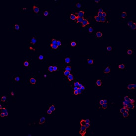 Lck was detected in immersion fixed human peripheral blood mononuclear cells (PBMCs) using Mouse Anti-Human Lck Monoclonal Antibody (Catalog # MAB3704) at 10 µg/mL for 3 hours at room temperature. Cells were stained using the NorthernLights™ 557-conjugated Anti-Mouse IgG Secondary Antibody (red; Catalog # NL007) and counterstained with DAPI (blue). View our protocol for Fluorescent ICC Staining of Non-adherent Cells.