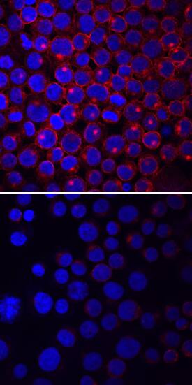 Lck phosphorylated at Y505 was detected in immersion fixed Jurkat human acute T cell leukemia cell line stimulated (upper panel) or not (lower panel) with pervanadate using Mouse Anti-Human Phospho-Lck (Y505) Monoclonal Antibody (Catalog # MAB7369) at 10 µg/mL for 3 hours at room temperature. Cells were stained using the NorthernLights™ 557-conjugated Anti-Mouse IgG Secondary Antibody (red; Catalog # NL007) and counterstained with DAPI (blue). Specific staining was localized to cell surfaces and cytoplasm. View our protocol for Fluorescent ICC Staining of Non-adherent Cells.