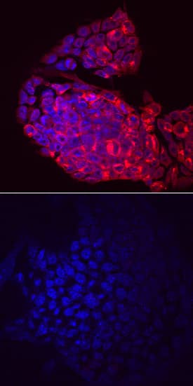 Lefty-2 was detected in immersion fixed D3 mouse embryonic stem cells untreated (lower panel) or stimulated (upper panel) with recombinant human/mouse/rat Activin A (Catalog # 338-AC) using Sheep Anti-Mouse Lefty-2 Antigen Affinity-purified Polyclonal Antibody (Catalog # AF7648) at 10 µg/mL for 3 hours at room temperature. Cells were stained using the NorthernLights™ 557-conjugated Anti-Sheep IgG Secondary Antibody (red; Catalog # NL010) and counterstained with DAPI (blue). Specific staining was localized to the cytoplasm of Activin A-stimulated cells. View our protocol for Fluorescent ICC Staining of Cells on Coverslips.