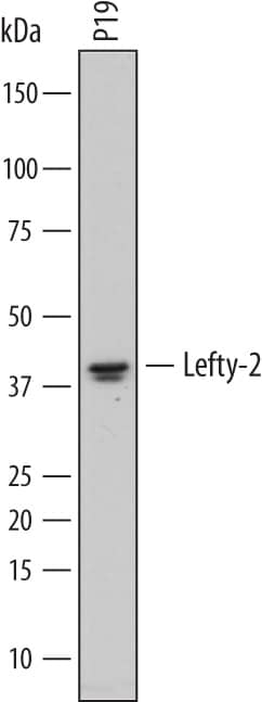 Western blot shows lysates of P19 mouse embryonal carcinoma cell line. PVDF membrane was probed with 2 µg/mL of Sheep Anti-Mouse Lefty-2 Antigen Affinity-purified Polyclonal Antibody (Catalog # AF7648) followed by HRP-conjugated Anti-Sheep IgG Secondary Antibody (Catalog # HAF016). A specific band was detected for Lefty-2 at approximately 40 kDa (as indicated). This experiment was conducted under reducing conditions and using Immunoblot Buffer Group 1.