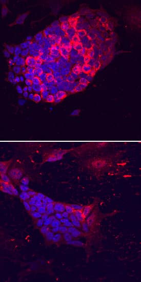 Lefty-2 was detected in immersion fixed D3 mouse embryonic stem cell line cultured with (upper panel) or without (lower panel) Recombinant Human/Mouse/Rat Activin A (Catalog # 338-AC) using Rat Anti-Mouse Lefty-2 Monoclonal Antibody (Catalog # MAB7648) at 10 µg/mL for 3 hours at room temperature. Cells were stained using the NorthernLights™ 557-conjugated Anti-Rat IgG Secondary Antibody (red; Catalog # NL013) and counterstained with DAPI (blue). Specific staining was localized to the perinuclear region. View our protocol for Fluorescent ICC Staining of Cells on Coverslips.