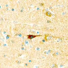 Leptin R was detected in immersion fixed paraffin-embedded sections of human brain using Goat Anti-Human Leptin R Antigen Affinity-purified Polyclonal Antibody (Catalog # AF389) at 25 µg/mL overnight at 4 °C. Tissue was stained using the Anti-Goat HRP-DAB Cell & Tissue Staining Kit (brown; Catalog # CTS008) and counterstained with hematoxylin (blue). Specific staining was localized to neurons. View our protocol for Chromogenic IHC Staining of Paraffin-embedded Tissue Sections.