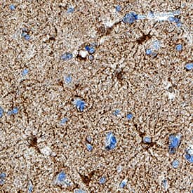   Leptin R  was detected in immersion fixed paraffin-embedded sections of human brain  (cortex) using Mouse Anti-Human Leptin R Monoclonal Antibody  (Catalog # MAB867R) at 0.5 µg/mL for 1 hour at room  temperature followed by incubation with the Anti-Mouse IgG  VisUCyte™ HRP Polymer Antibody (Catalog # VC001).  Before incubation with the primary antibody, tissue was subjected to  heat-induced epitope retrieval using Antigen Retrieval Reagent-Basic (Catalog  # CTS013).  Tissue was stained using DAB (brown) and counterstained with hematoxylin  (blue). Specific staining was localized to cell bodies and processes. View  our protocol for IHC  Staining with VisUCyte HRP Polymer Detection Reagents.