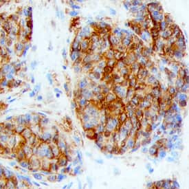 Immunohistochemistry Ly6K Antibody