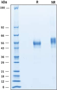 2 μg/lane of Recombinant Mouse Lymphotoxin alpha1/beta2 was resolved with SDS-PAGE under reducing (R) and non-reducing (NR) conditions and visualized by Coomassie® blue staining, showing bands at 42-63 kDa.