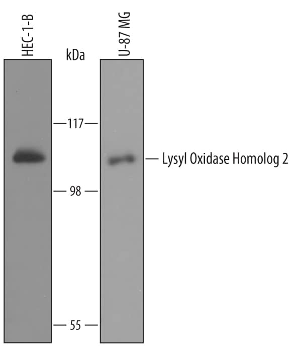 Western blot shows lysates of HEC-1-B human endometrial adenocarcinoma cell line and U-87 MG human glioblastoma/astrocytoma cell line. PVDF Membrane was probed with 1 µg/mL of Goat Anti-Human Lysyl Oxidase Homolog 2/LOXL2 Antigen Affinity-purified Polyclonal Antibody (Catalog # AF2639) followed by HRP-conjugated Anti-Goat IgG Secondary Antibody (Catalog # HAF019). A specific band was detected for Lysyl Oxidase Homolog 2/LOXL2 at approximately 105 kDa (as indicated). This experiment was conducted under reducing conditions and using Immunoblot Buffer Group 8.