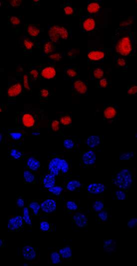 MARCH8 was detected in immersion fixed immature human dendritic cells using Mouse Anti-Human/Mouse/Rat MARCH8 Monoclonal Antibody (Catalog # MAB6969) at 10 µg/mL for 3 hours at room temperature. Cells were stained using the NorthernLights™ 557-conjugated Anti-Mouse IgG Secondary Antibody (red, upper panel; Catalog # NL007) and counterstained with DAPI (blue, lower panel). Specific staining was localized to nuclei. View our protocol for Fluorescent ICC Staining of Non-adherent Cells.