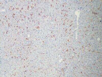 Immunohistochemistry: MARCO Antibody [NBP2-39004] - Staining in normal human liver. Image from a verified customer review.