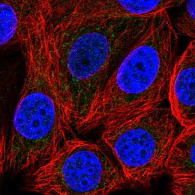 MCART1 Antibody (NBP2-55344): Novus Biologicals