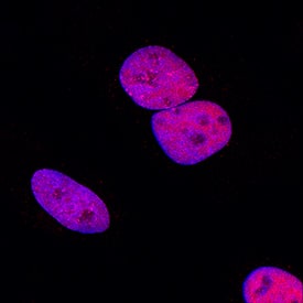 MCM7 was detected in immersion fixed HeLa human cervical epithelial carcinoma cell line using Rabbit Anti-Human MCM7 Monoclonal Antibody (Catalog # MAB9217) at 1 µg/mL for 3 hours at room temperature. Cells were stained using the NorthernLights™ 557-conjugated Anti-Rabbit IgG Secondary Antibody (red; Catalog # NL004) and counterstained with DAPI (blue). Specific staining was localized to nuclei. View our protocol for Fluorescent ICC Staining of Cells on Coverslips.