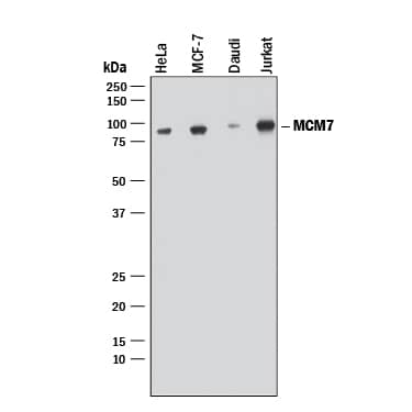 Western blot shows lysates of HeLa human cervical epithelial carcinoma cell line, MCF-7 human breast cancer cell line, Daudi human Burkitt's lymphoma cell line, and Jurkat human acute T cell leukemia cell line. PVDF membrane was probed with 0.2 µg/mL of Rabbit Anti-Human MCM7 Monoclonal Antibody (Catalog # MAB9217) followed by HRP-conjugated Anti-Rabbit IgG Secondary Antibody (Catalog # HAF008). A specific band was detected for MCM7 at approximately 80 kDa (as indicated). This experiment was conducted under reducing conditions and using Immunoblot Buffer Group 1.
