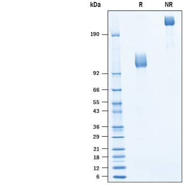 2 μg/lane of Biotinylated Recombinant Human M-CSF R/CD115 Fc Chimera Avi-tag (Catalog # AVI10339) was  resolved with SDS-PAGE under reducing (R) and non-reducing (NR)  conditions and visualized by Coomassie® Blue staining, showing bands at 100-120 kDa and 200-240 kDa, respectively.