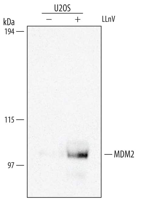 U2OS human osteosarcoma cell line was untreated (-) or treated (+) with proteasome inhibitor LLnV for 1 hour. MDM2 was immunoprecipitated from 500 µg of cell lysate following incubation with 2-3 µg Mouse Anti-Human MDM2 Monoclonal Antibody (Catalog # MAB1244) for 1 hour on ice. MDM2-antibody complexes were absorbed using goat anti-mouse agarose (Sigma). Immunoprecipitated MDM2 was detected by Western blot using 1 µg/mL Human/Mouse/Rat MDM2 Antigen Affinity-purified Polyclonal Antibody (Catalog # AF1244). View our recommended buffer recipes for immunoprecipitation.