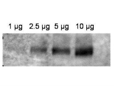 Western Blot: MDR1/ABCB1 Antibody [NB100-80870] - Analyis of anti-ABCB1 antibody shows detection of ABCB1 in crude membrane extracts from HF insect cells over-expressing human ABCB1. The extract was loaded onto a gel in the amounts indicated followed by electrophoresis and transfer to nitrocellulose. The membrane was probed with the primary antibody diluted to 1:600, followed by Peroxidase Conjugated Affinity Purified Anti-RABBIT IgG at 1:10000. Personal Communication, Anna Calcagno, CCR-NCI, Bethesda, MD.