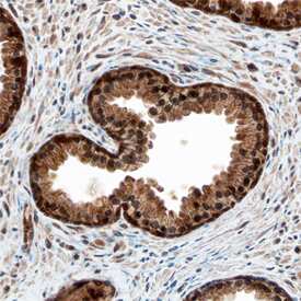 MED4 was detected in immersion fixed paraffin-embedded sections of human prostate using Goat Anti-Human MED4 Antigen Affinity-purified Polyclonal Antibody (Catalog # AF5089) at 3 µg/mL overnight at 4 °C. Before incubation with the primary antibody, tissue was subjected to heat-induced epitope retrieval using Antigen Retrieval Reagent-Basic (Catalog # CTS013). Tissue was stained using the Anti-Goat HRP-DAB Cell & Tissue Staining Kit (brown; Catalog # CTS008) and counterstained with hematoxylin (blue). Specific staining was localized to nuclei in glandular epithelial cells. View our protocol for Chromogenic IHC Staining of Paraffin-embedded Tissue Sections.
