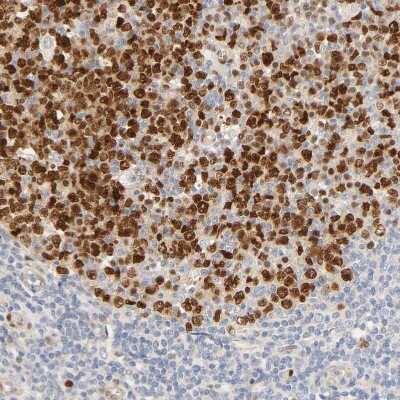 Immunohistochemistry-Paraffin: MEF2B Antibody [NBP1-93440] - Staining of human tonsil shows strong nuclear positivity in germinal center cells.