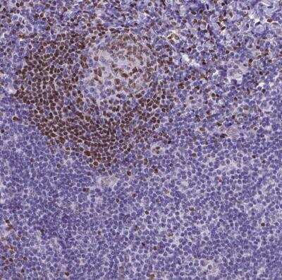 Immunohistochemistry-Paraffin: MEF2C Antibody [NBP1-89468] - Staining of human tonsil shows moderate nuclear positivity in germinal center cells.