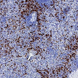   MICL/CLEC12A  was detected in immersion fixed paraffin-embedded sections of human spleen  using Rabbit Anti-Human MICL/CLEC12A Monoclonal Antibody (Catalog # MAB29461)  at 3 µg/mL for 1 hour at room temperature followed by  incubation with the Anti-Rabbit IgG VisUCyte™ HRP Polymer Antibody  (Catalog # VC003).  Before incubation with the primary antibody, tissue was subjected to  heat-induced epitope retrieval using Antigen Retrieval Reagent-Basic (Catalog  # CTS013).  Tissue was stained using DAB (brown) and counterstained with hematoxylin  (blue). Specific staining was localized to cytoplasm in lymphocytes. View our  protocol for IHC  Staining with VisUCyte HRP Polymer Detection Reagents.