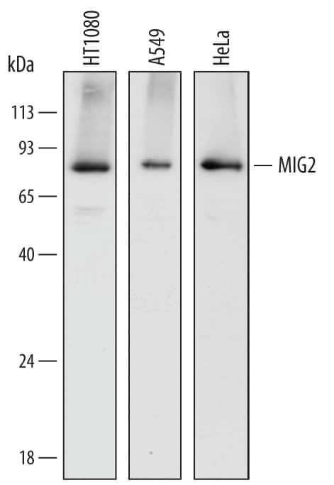 Western blot shows lysates of HT1080 human fibrosarcoma cell line, A549 human lung carcinoma cell line, and HeLa human cervical epithelial carcinoma cell line. PVDF membrane was probed with 0.5 µg/mL of Mouse Anti-Human MIG2 Monoclonal Antibody (Catalog # MAB6984) followed by HRP-conjugated Anti-Mouse IgG Secondary Antibody (Catalog # HAF007). A specific band was detected for MIG2 at approximately 78 kDa (as indicated). This experiment was conducted under reducing conditions and using Immunoblot Buffer Group 1.