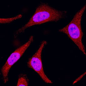 MKK3 was detected in immersion fixed HeLa human cervical epithelial carcinoma cell line using Mouse Anti-Human/Mouse/Rat MKK3 Monoclonal Antibody (Catalog # MAB2515) at 25 µg/mL for 3 hours at room temperature. Cells were stained using the NorthernLights™ 557-conjugated Anti-Mouse IgG Secondary Antibody (red; Catalog # NL007) and counterstained with DAPI (blue). Specific staining was localized to cytoplasm and nuclei. View our protocol for Fluorescent ICC Staining of Cells on Coverslips.