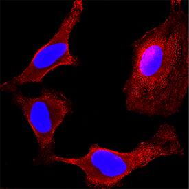 MKK4 was detected in immersion fixed HeLa human cervical epithelial carcinoma cell line using Mouse Anti-Human MKK4 Monoclonal Antibody (Catalog # MAB3390) at 3 µg/mL for 3 hours at room temperature. Cells were stained using the NorthernLights™ 557-conjugated Anti-Mouse IgG Secondary Antibody (red; Catalog # NL007) and counterstained with DAPI (blue). Specific staining was localized to cytoplasm and nuclei. View our protocol for Fluorescent ICC Staining of Cells on Coverslips.