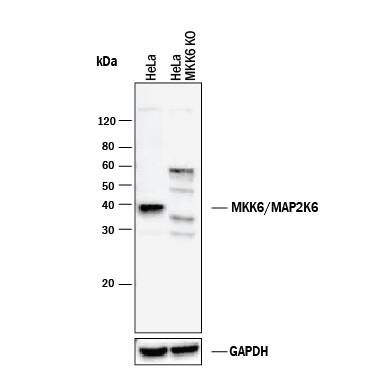 <b>Genetic Strategies Validation. </b>Western blot shows lysates of HeLa human cervical epithelial carcinoma parental cell line and MKK6 knockout HeLa cell line (KO). PVDF membrane was probed with 0.2 µg/mL of Goat Anti-Human/Mouse/Rat MKK6 Antigen Affinity-purified Polyclonal Antibody (Catalog # AF16041) followed by HRP-conjugated Anti-Goat IgG Secondary Antibody (Catalog # HAF017). A specific band was detected for MKK6 at approximately 39 kDa (as indicated) in the parental HeLa cell line, but is not detectable in knockout HeLa cell line. GAPDH (Catalog # AF5718) is shown as a loading control. This experiment was conducted under reducing conditions and using Immunoblot Buffer Group 1.