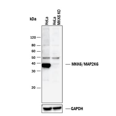 <b>Genetic Strategies Validation. </b>Western blot shows lysates of HeLa human cervical epithelial carcinoma parental cell line and MKK6 knockout HeLa cell line (KO). PVDF membrane was probed with 0.2 µg/mL of Rabbit Anti-Human/Mouse/Rat MKK6 Antigen Affinity-purified Polyclonal Antibody (Catalog # AF1604) followed by HRP-conjugated Anti-Rabbit IgG Secondary Antibody (Catalog # HAF008). A specific band was detected for MKK6 at approximately 39 kDa (as indicated) in the parental HeLa cell line, but is not detectable in knockout HeLa cell line. GAPDH (Catalog # AF5718) is shown as a loading control. This experiment was conducted under reducing conditions and using Immunoblot Buffer Group 1.