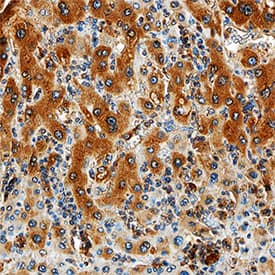 MMP-1 was detected in immersion fixed paraffin-embedded sections of human liver using Recombinant Mouse Anti-Human MMP-1 Monoclonal Antibody (Catalog # MAB901R) at 15 µg/mL overnight at 4 °C. Tissue was stained using the Anti-Mouse HRP-DAB Cell & Tissue Staining Kit (brown; Catalog # CTS002) and counterstained with hematoxylin (blue). Specific staining was localized to cytoplasm in hepatocytes. View our protocol for Chromogenic IHC Staining of Paraffin-embedded Tissue Sections.