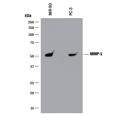 Western blot shows lysates of IMR-90 human lung fibroblast cell line and PC-3 human prostate cancer cell line. PVDF membrane was probed with 2 µg/mL of Recombinant Mouse Anti-Human MMP-1 Monoclonal Antibody (Catalog # MAB901R) followed by HRP-conjugated Anti-Mouse IgG Secondary Antibody (Catalog # HAF018). A specific band was detected for MMP-1 at approximately 50 kDa (as indicated). This experiment was conducted under reducing conditions and using Immunoblot Buffer Group 1.