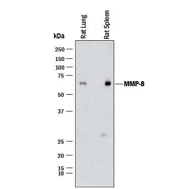 Western blot shows lysates of rat lung tissue and rat spleen tissue. PVDF membrane was probed with 0.5 µg/mL of Goat Anti-Mouse/Rat MMP-8 Antigen Affinity-purified Polyclonal Antibody (Catalog # AF3245) followed by HRP-conjugated Anti-Goat IgG Secondary Antibody (Catalog # HAF017). A specific band was detected for MMP-8 at approximately 53 kDa (as indicated). This experiment was conducted under reducing conditions and using Immunoblot Buffer Group 1.