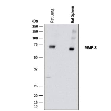 Western blot shows lysates of rat lung tissue and rat spleen tissue. PVDF membrane was probed with 1 µg/mL of Mouse Anti-Rat MMP-8 Monoclonal Antibody (Catalog # MAB3245) followed by HRP-conjugated Anti-Mouse IgG Secondary Antibody (Catalog # HAF018). A specific band was detected for MMP-8 at approximately 53 kDa (as indicated). This experiment was conducted under reducing conditions and using Immunoblot Buffer Group 1.