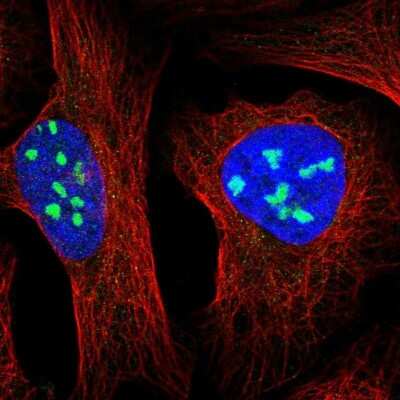 MPHOSPH10 Antibody (NBP2-38232): Novus Biologicals