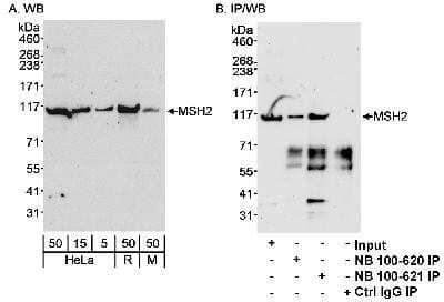 Western Blot: MSH2 Antibody [NB100-621] - Detection of human and mouse MSH2 by Western blot and immunoprecipitation using NB100-621. Detection: ECL with a 3 minute exposure.