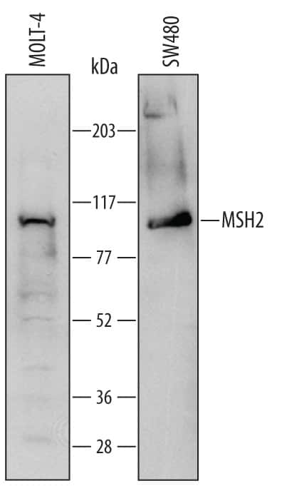 Western blot shows lysates of MOLT-4 human acute lymphoblastic leukemia cell line and SW480 human colorectal adenocarcinoma cell line. PVDF Membrane was probed with 2 µg/mL of Sheep Anti-Human MSH2 Antigen Affinity-purified Polyclonal Antibody (Catalog # AF6780) followed by HRP-conjugated Anti-Sheep IgG Secondary Antibody (Catalog # HAF016). A specific band was detected for MSH2 at approximately 100 kDa (as indicated). This experiment was conducted under reducing conditions and using Immunoblot Buffer Group 1.