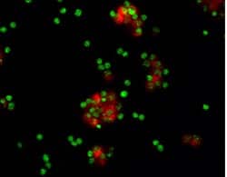 MSK1 was detected in immersion fixed human lymphocytes using 8 µg/mL Human MSK1 Monoclonal Antibody (Catalog # MAB2518) for 3 hours at room temperature. Cells were stained (red) and counterstained (green). View our protocol for Fluorescent ICC Staining of Non-adherent Cells.