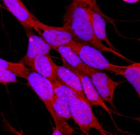 MST1/STK4 was detected in immersion fixed SH-SY5Y human neuroblastoma cell line using Goat Anti-Human MST1/STK4 Antigen Affinity-purified Polyclonal Antibody (Catalog # AF4939) at 10 µg/mL for 3 hours at room temperature. Cells were stained using the NorthernLights™ 557-conjugated Anti-Goat IgG Secondary Antibody (red; Catalog # NL001) and counterstained with DAPI (blue). Specific staining was localized to cytoplasm. View our protocol for Fluorescent ICC Staining of Cells on Coverslips.